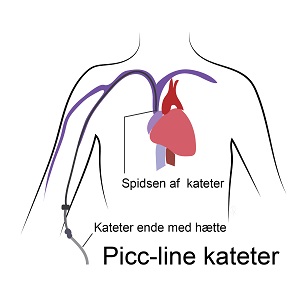 Picc-line kateter