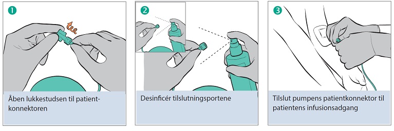 Tilkobling af pumpe til patient